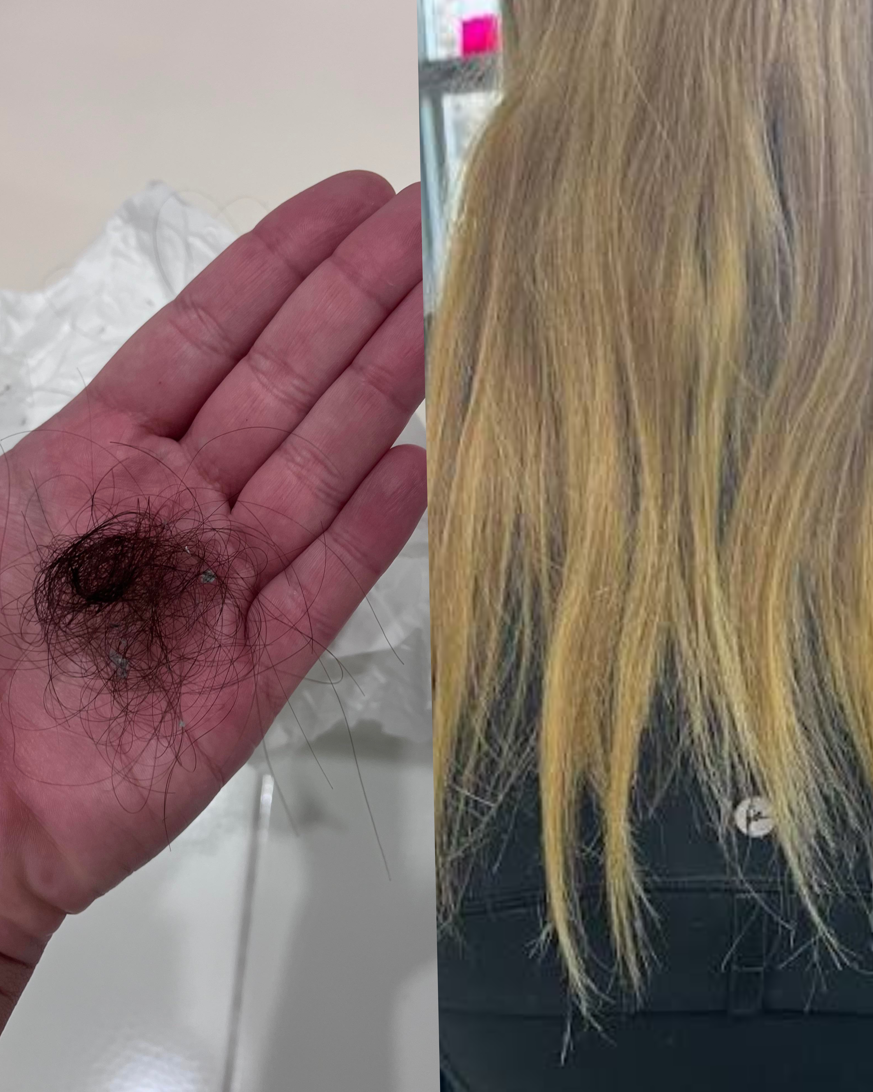 Hair Breakage vs. Hair Shedding: How to Tell the Difference