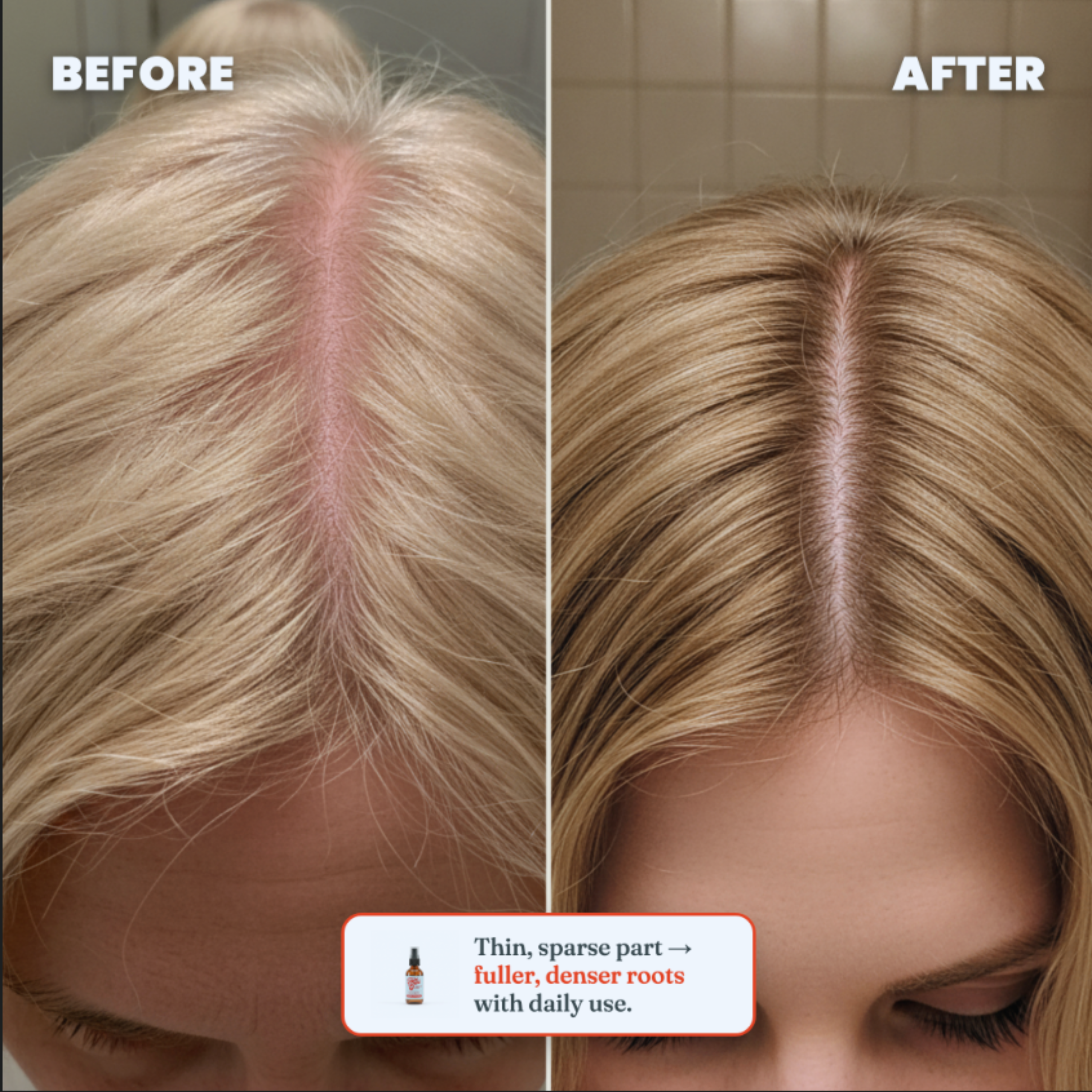 Hair Growth Nourishing Spray