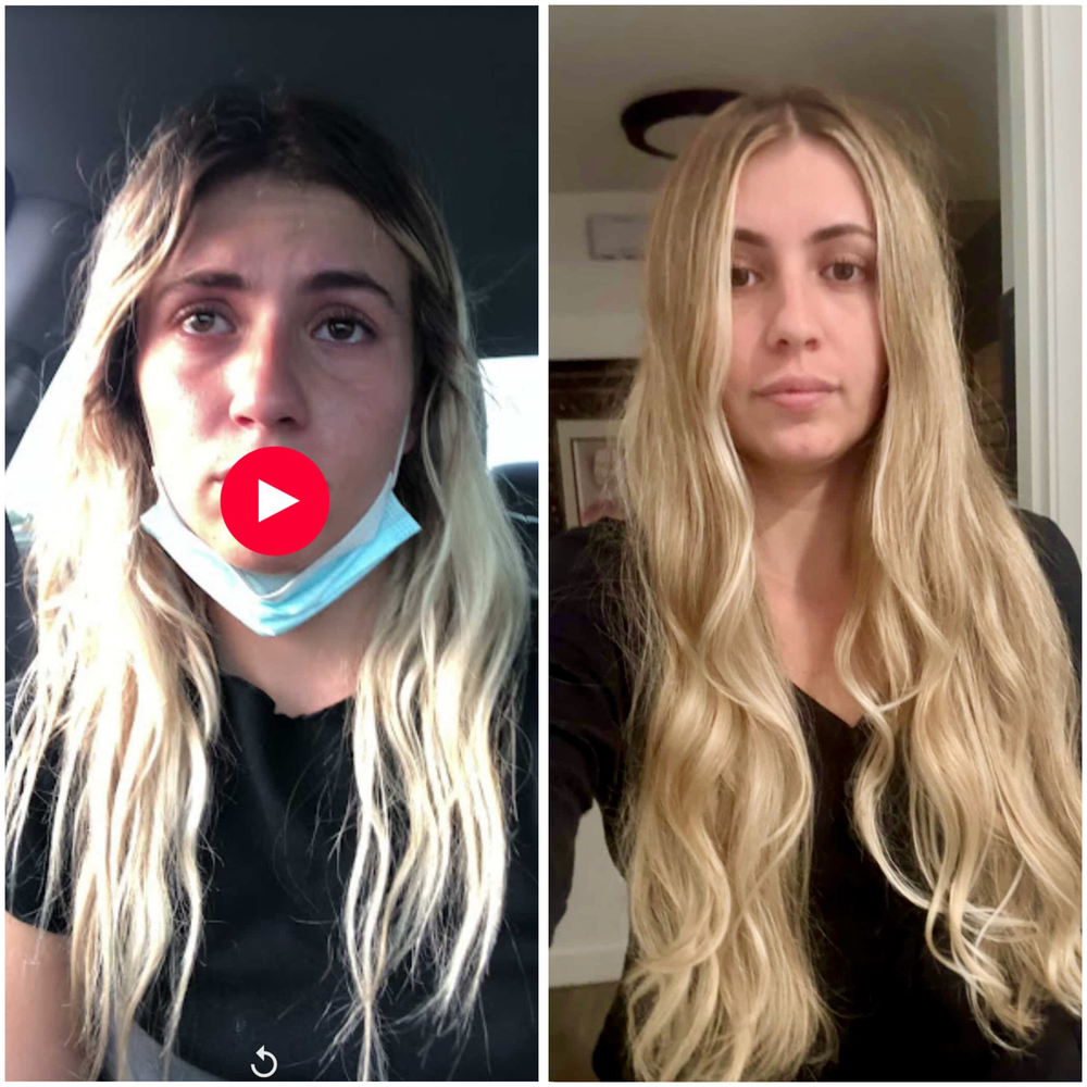 Before and after
